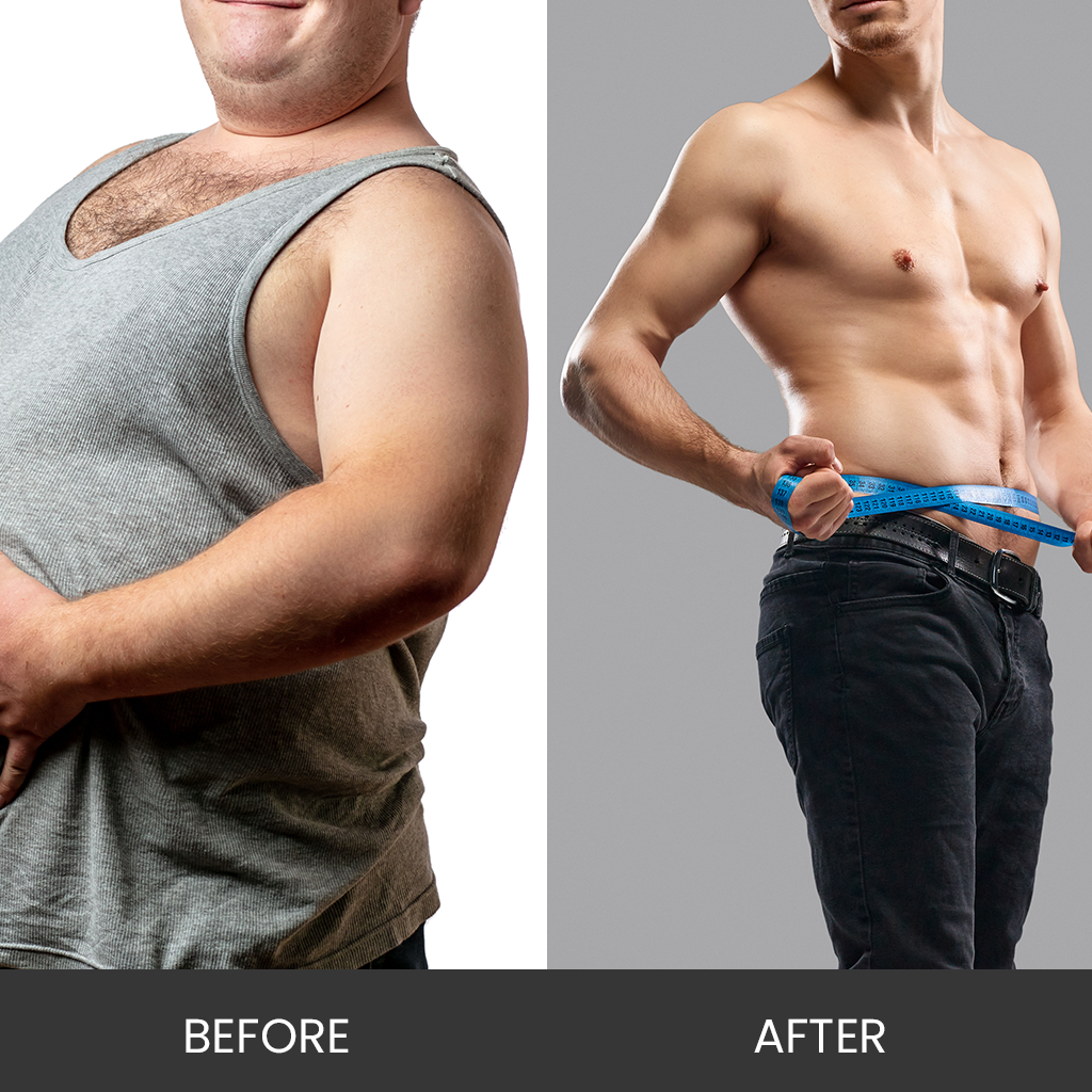 MIC B12 injections for weight loss 1